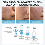 Hyaluronic Acid Face Serum Anti - Aging Shrink Pore Whitening Moisturizing Face Cream Dry Skin Care - Oopsdadforgot.com