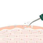 Ultrasonic Skin Rejuvenation Whitening Shoveling Machine Exfoliating Skin Care - Oopsdadforgot.com
